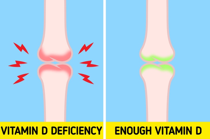 dau hieu canh bao ban dang thieu vitamin d hinh anh 4