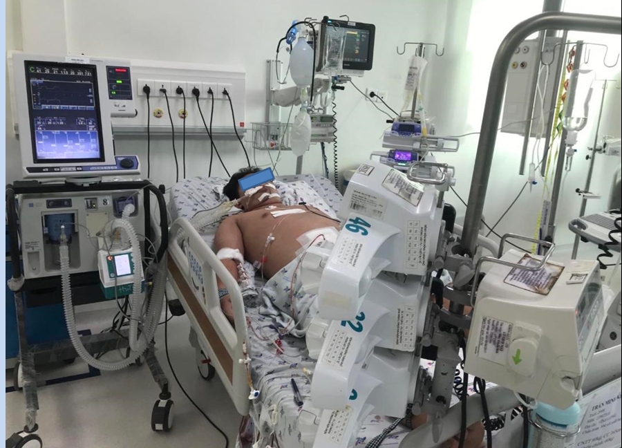 cứu sống 5 trẻ sốc sốt xuất huyết nặng, tổn thương đa cơ quan hình ảnh 1 cuu song 5 tre soc sot xuat huyet nang, ton thuong da co quan hinh anh 1