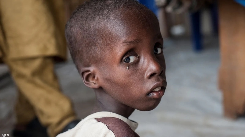 Cộng đồng tiếp cận các hình ảnh tuyệt đẹp về cuộc đói ở châu Phi