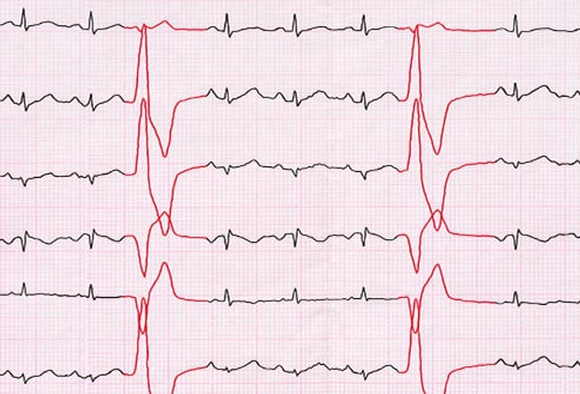 trieu chung cua benh ung thu phoi ma ban khong he ngo toi hinh anh 9