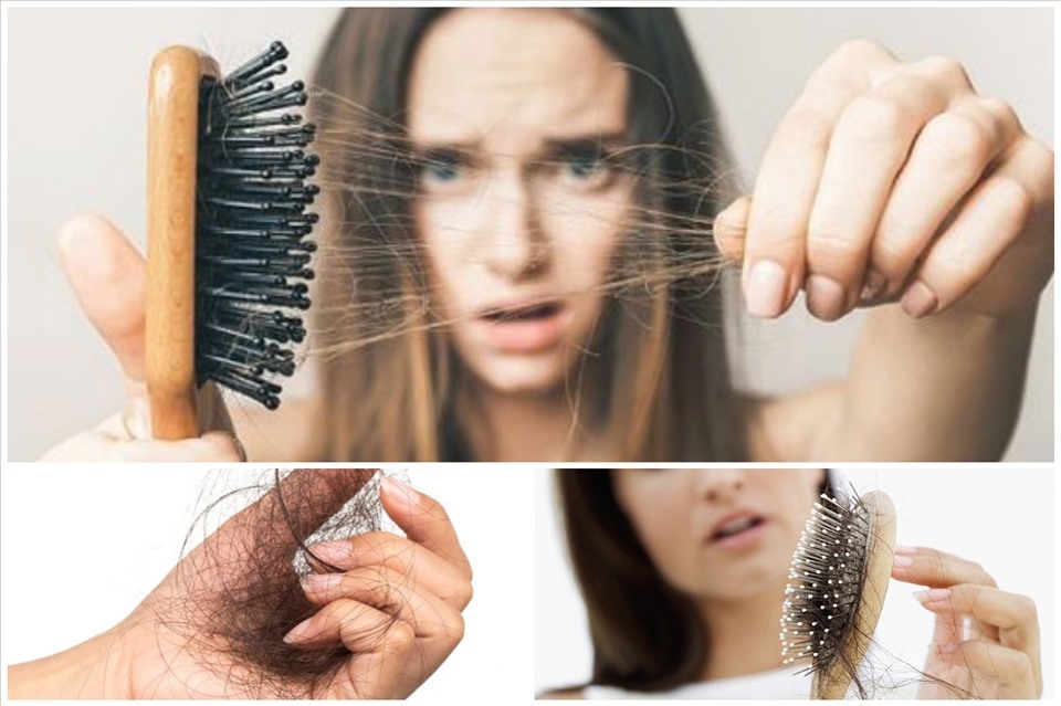 Ăn gì để tóc không rụng? 16 Thực phẩm chống rụng tóc hiệu quả | Rungtoc.vn