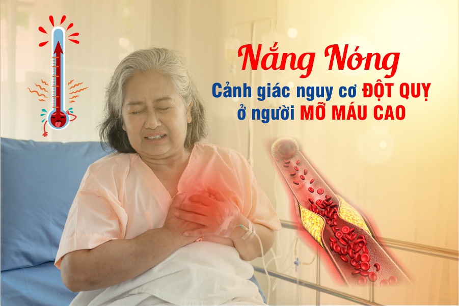 Mùa nắng nóng, cẩn trọng đột quỵ do mỡ máu cao