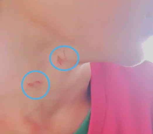 Bé trai 14 tuổi bị cha dượng bạo hành, dùng bật lửa đốt vùng kín