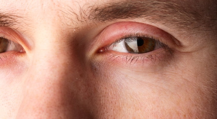 Quy tắc bảo vệ mắt khi phải dùng thiết bị điện tử hàng ngày