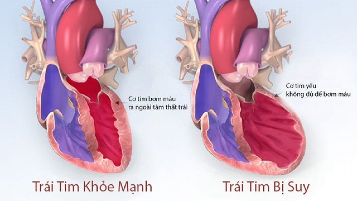 be 1 tuoi bi cao huyet ap hinh anh 1