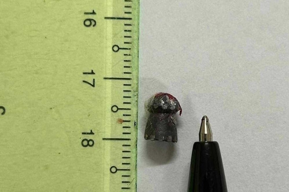 nguoi dan ong dang lam ray bi trung dan lac hinh anh 2