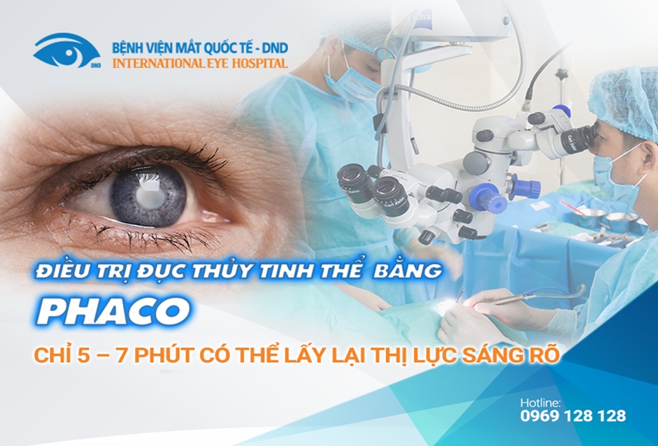 Duc thuy tinh the - ke danh cap anh sang tham lang hinh anh 4