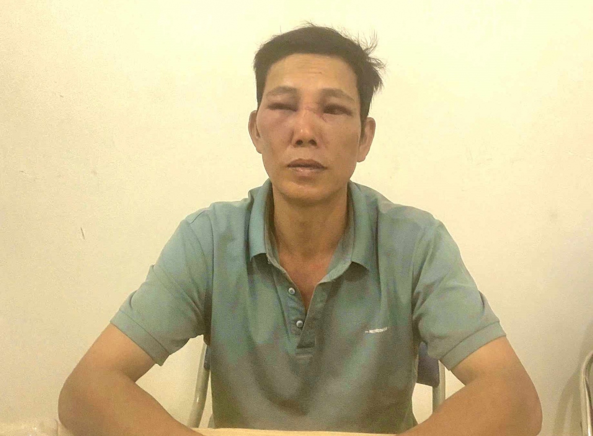 Sẵn hơi men, chém trọng thương bạn nhậu ở Đắk Lắk