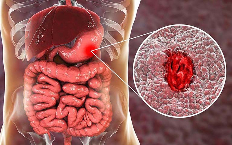 Xuất tinh ra máu có nguy hiểm không? Biến chứng tiềm ẩn?