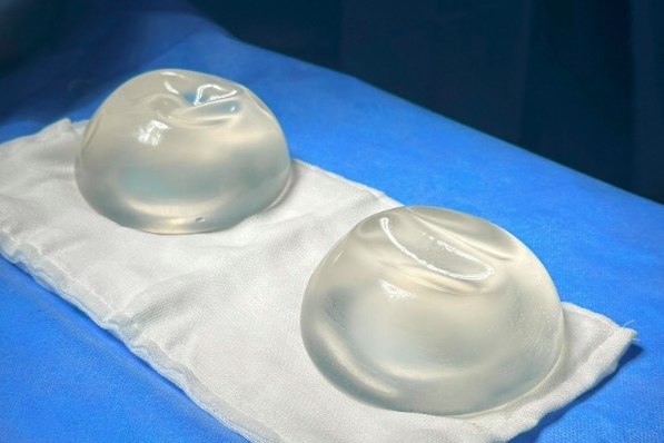 the risks of improper breast implant removal picture 1