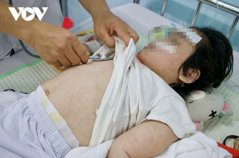 measles infections likely to rise in hanoi in coming months picture 1