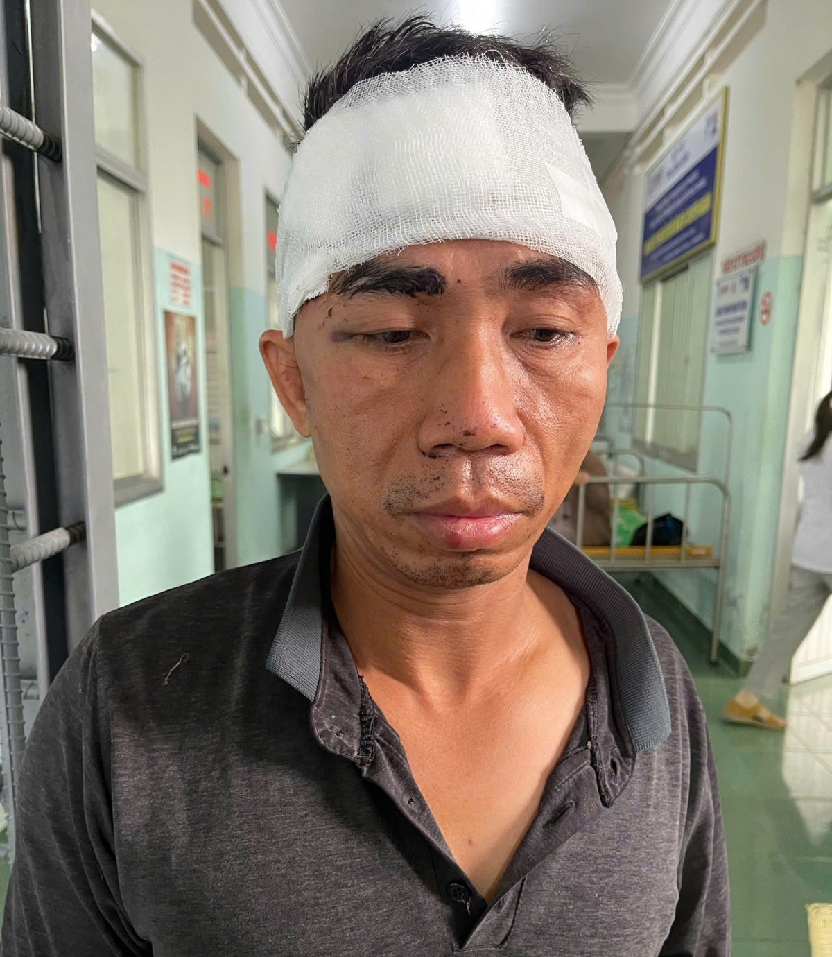 bắt kẻ dùng búa, bình xịt hơi cay tấn công chủ tiệm vàng cướp tài sản hình ảnh 1 bat ke dung bua, binh xit hoi cay tan cong chu tiem vang cuop tai san hinh anh 1