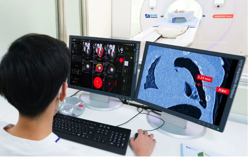 vietnam debuts world s fastest ct scanner featuring highest slice count picture 3 vietnam debuts world s fastest ct scanner featuring highest slice count picture 3