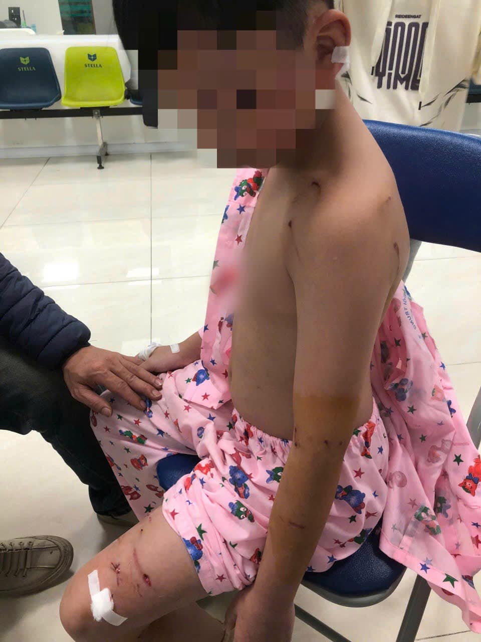 bị chó tấn công khi đi chúc tết, bé trai phải khâu 9 mũi hình ảnh 1 bi cho tan cong khi di chuc tet, be trai phai khau 9 mui hinh anh 1