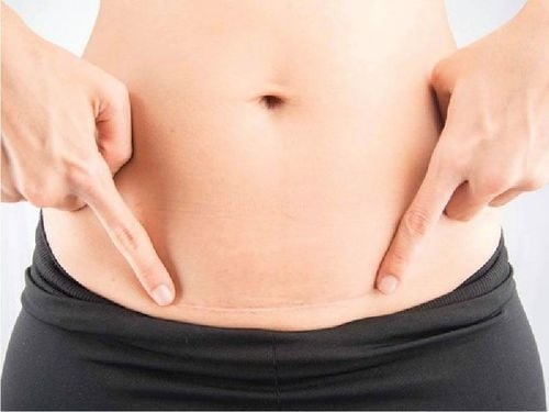 Sinh mổ lần 3 có nguy hiểm cho mẹ và bé hay không?