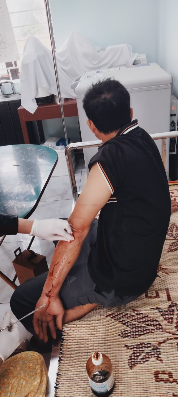 Đang làm việc, công nhân khai thác đá bị chém trọng thương