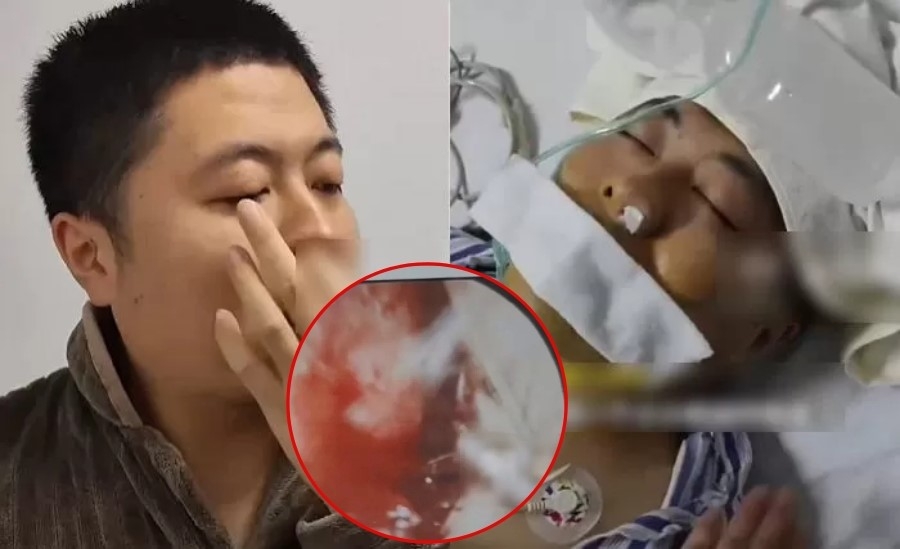 người đàn ông vỡ động mạch, nhập viện cấp cứu vì thói quen nhiều người mắc phải hình ảnh 1 nguoi dan ong vo dong mach, nhap vien cap cuu vi thoi quen nhieu nguoi mac phai hinh anh 1