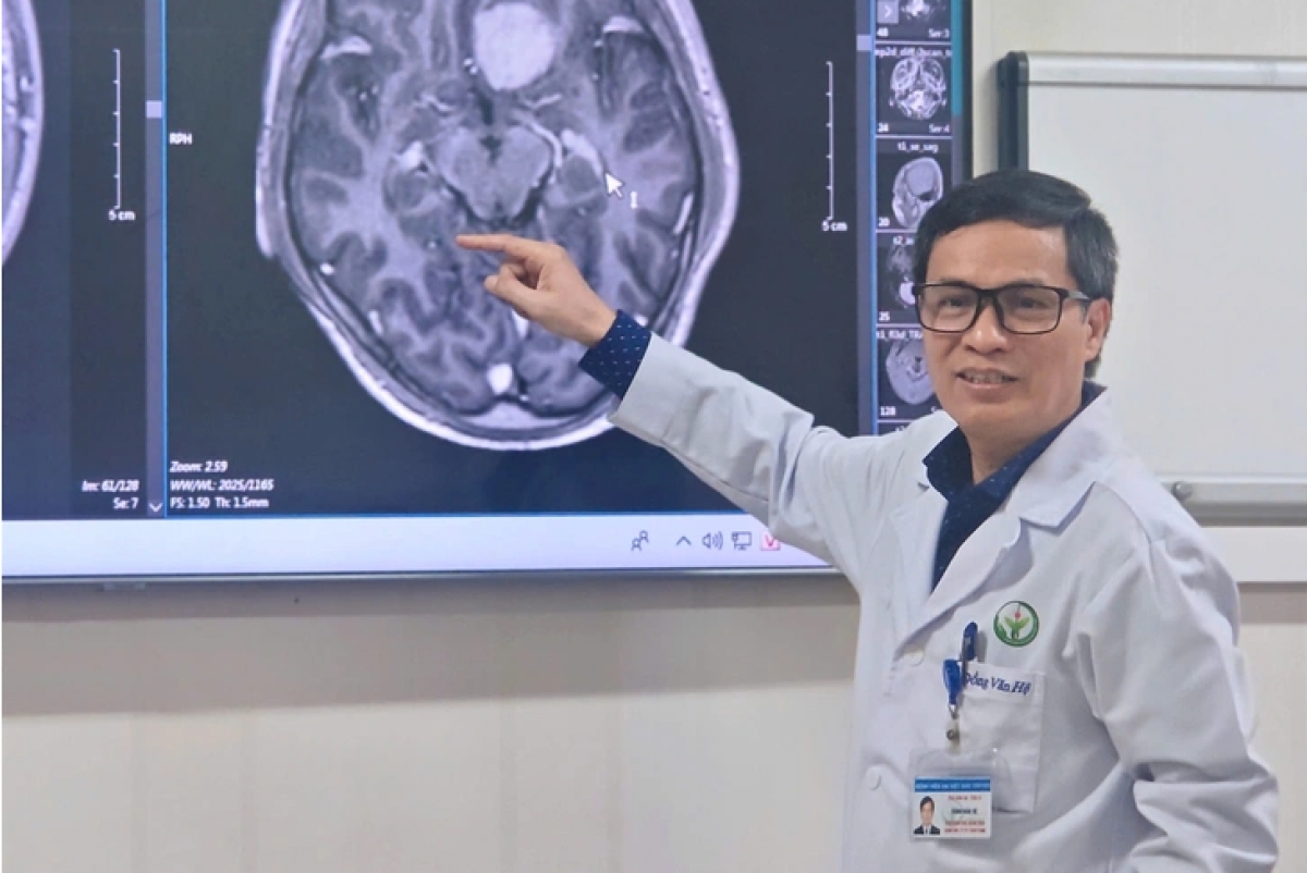 Lần đầu tiên bệnh nhân u não được phẫu thuật nội soi qua cung mày