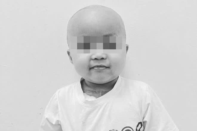 Bé Bắp qua đời sau thời gian dài chống chọi với bệnh ung thư