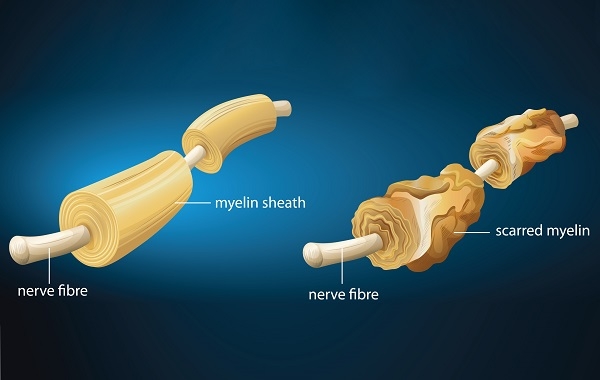 U80 lo lắng vì "cậu nhỏ" đột nhiên bị cong bất thường