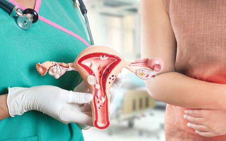Bị lạc nội mạc tử cung có chữa dứt điểm được không?