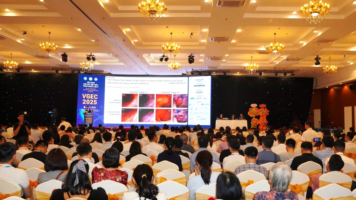 thành lập trung tâm nội soi chuyên sâu hiện đại tại Đbscl hình ảnh 3 thanh lap trung tam noi soi chuyen sau hien dai tai Dbscl hinh anh 3