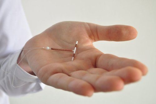 Vòng tránh thai để quên gần 20 năm đang gây viêm nhiễm phải làm sao?