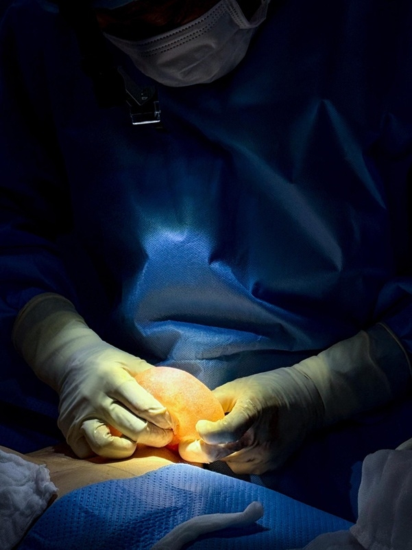 trước phẫu thuật thẩm mỹ có cần ngưng uống thực phẩm chức năng hình ảnh 1 truoc phau thuat tham my co can ngung uong thuc pham chuc nang hinh anh 1