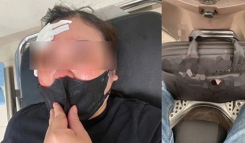 Điều tra vụ tài xế bán tải vụt dùi cui vào người phụ nữ đi xe máy tại hà nội hình ảnh 1 Dieu tra vu tai xe ban tai vut dui cui vao nguoi phu nu di xe may tai ha noi hinh anh 1