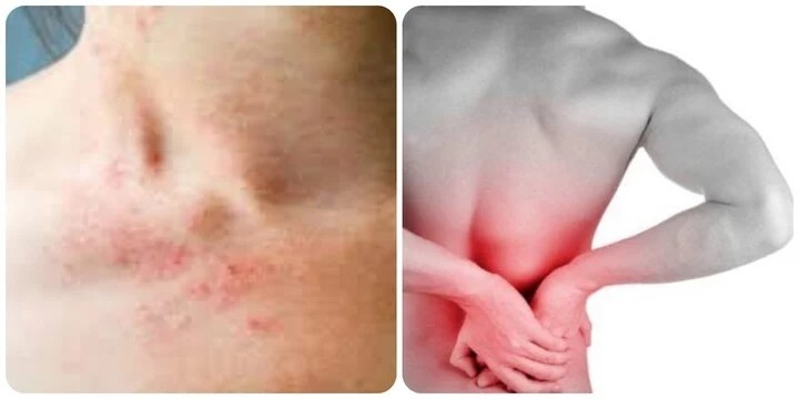 Triệu chứng suy thận nhẹ bạn cần biết