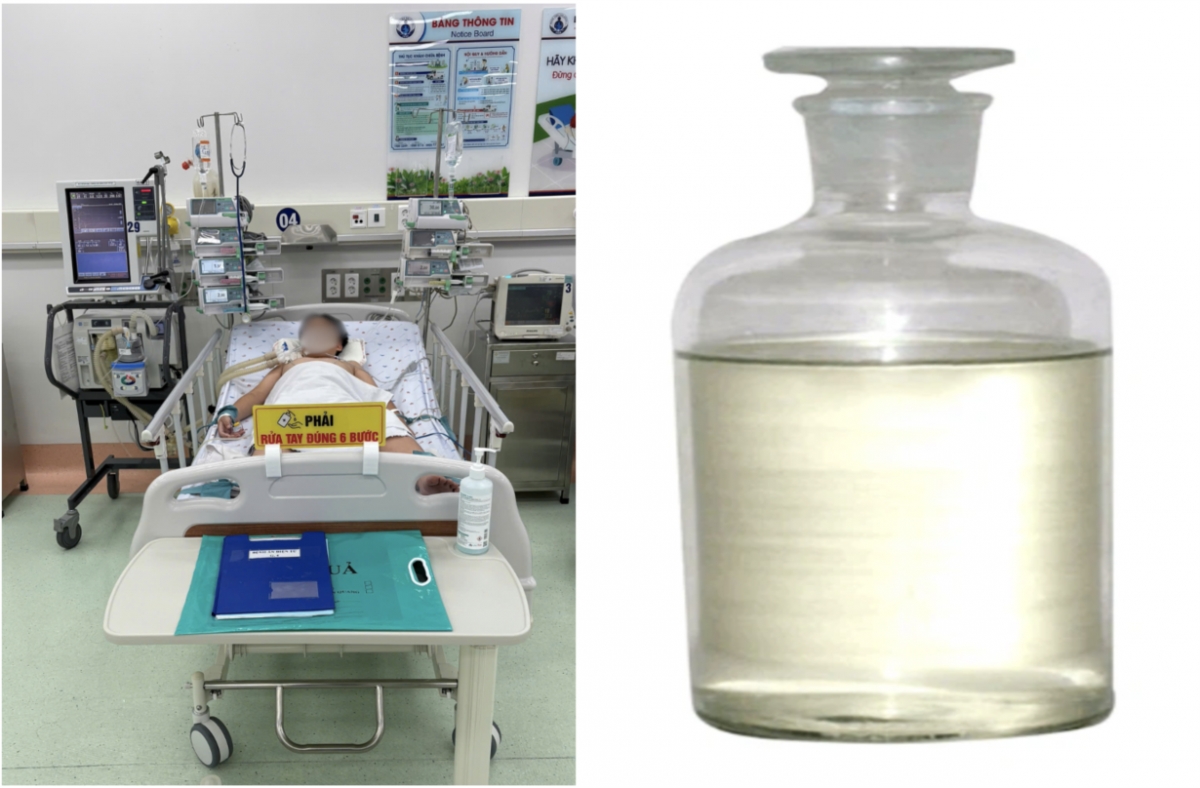 bé trai hôn mê, suy hô hấp nặng do hít phải khí độc từ hóa chất hàn nhựa hình ảnh 1 be trai hon me, suy ho hap nang do hit phai khi doc tu hoa chat han nhua hinh anh 1