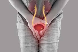 55 tuổi, huyết áp cao nhưng vẫn "quan hệ" ngày 3 lần