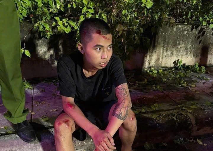 vu 2 quai xe dam trong thuong dai uy cscD khoi to vu an de dieu tra hanh vi giet nguoi hinh anh 1
