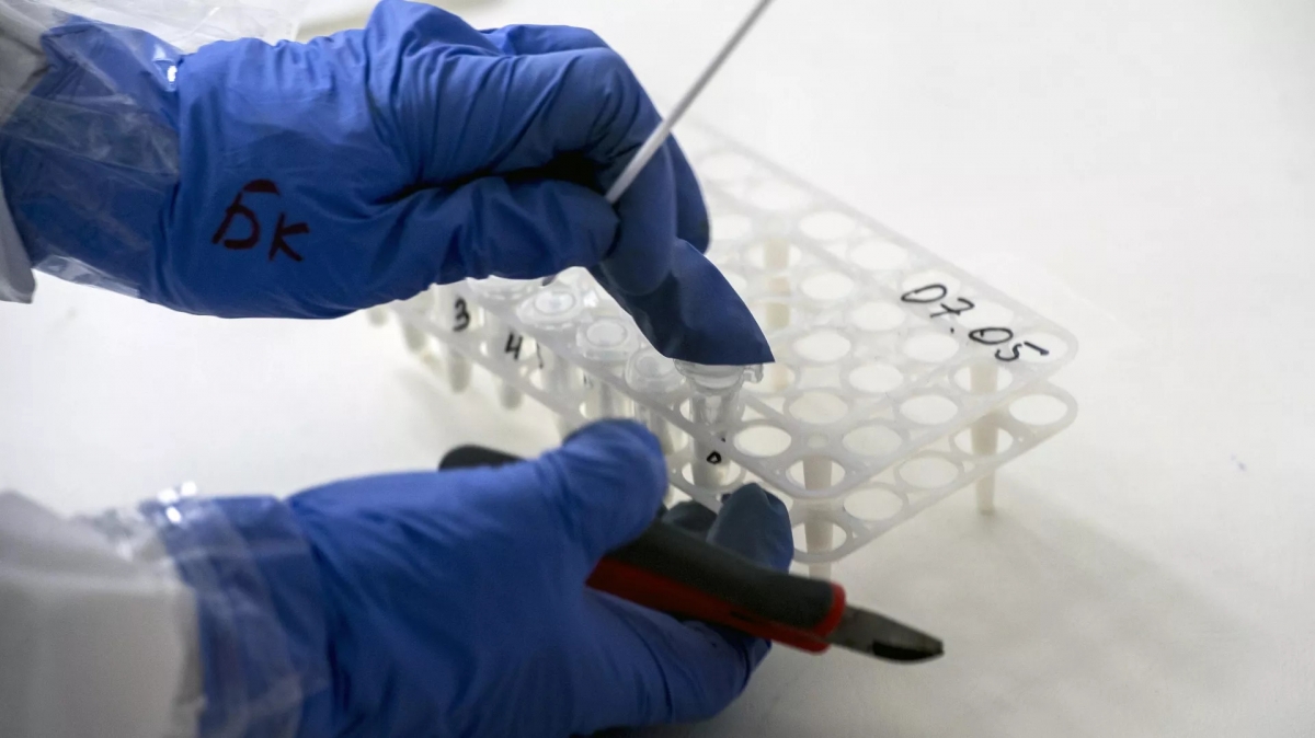 Nga tạo ra xét nghiệm y tế đầu tiên phát hiện đồng thời 25 loại virus