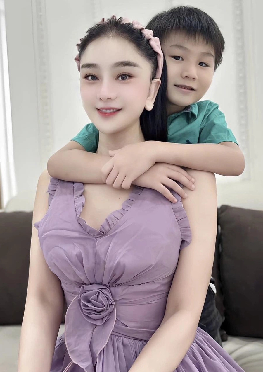 sao viet 30 9 nhan sac lam khanh chi sau khi phau thuat tham my lan thu 10 hinh anh 1