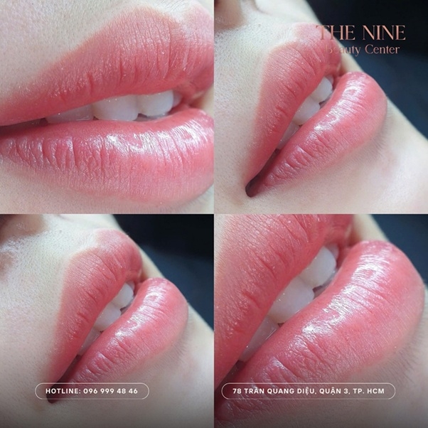 the nine beauty center chuyen chinh sua may hong, phun xam tham my hinh anh 1