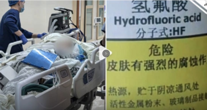 giam phai nuoc hoa tan xuong khi di dao, nguoi phu nu chet sau 5 ngay hinh anh 1