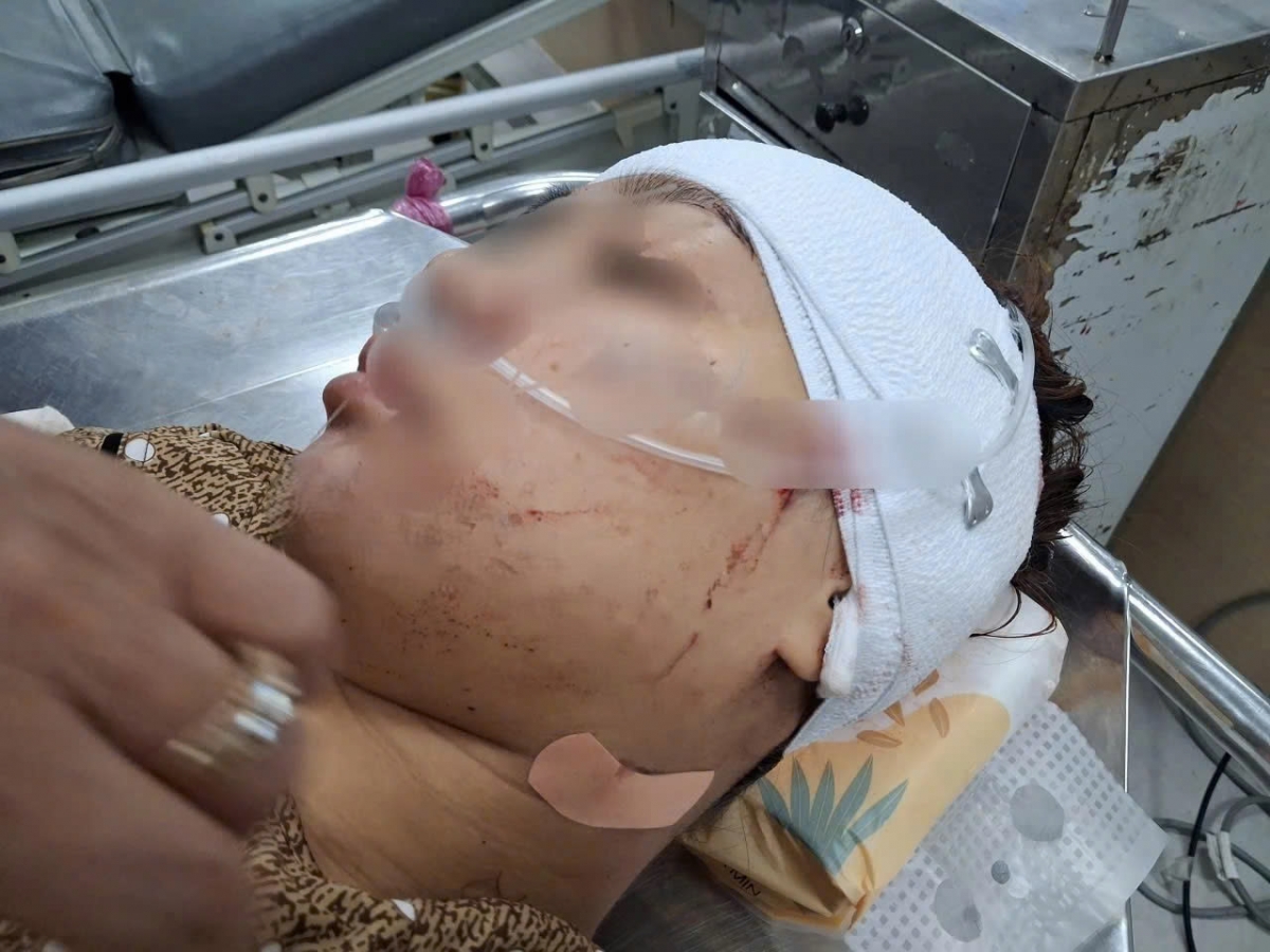 Nữ công chức rạch mặt “tình địch” vì ghen tuông đối mặt vòng lao lý