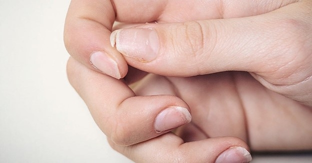 6 dau hieu cho thay co the dang thieu canxi, can bo sung nhanh nhat co the hinh anh 1