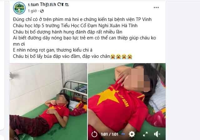 be gai nhap vien nghi do cha duong hanh hung hinh anh 2