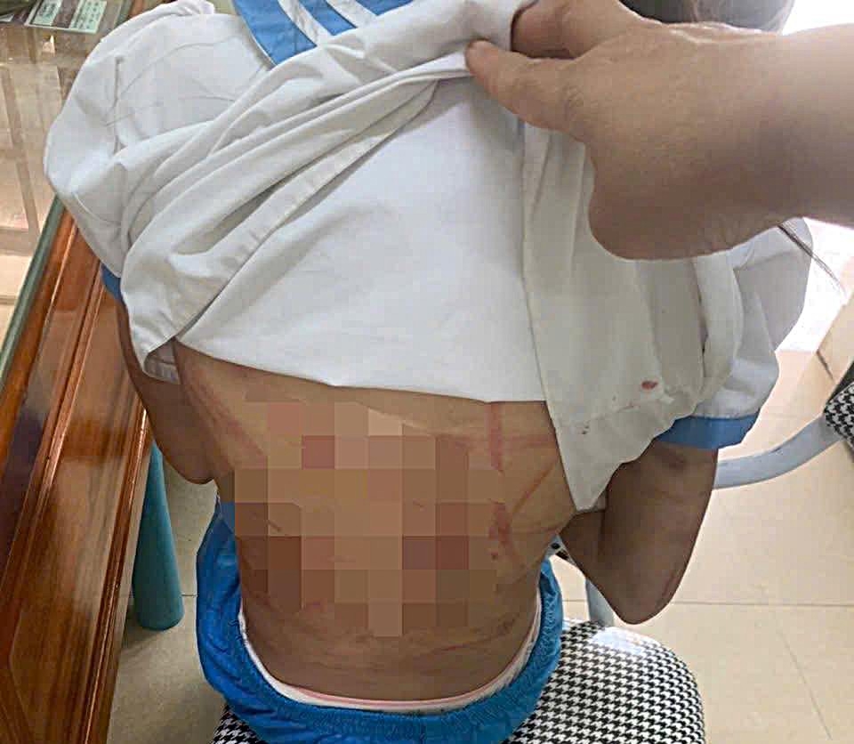 be gai nhap vien nghi do cha duong hanh hung hinh anh 1