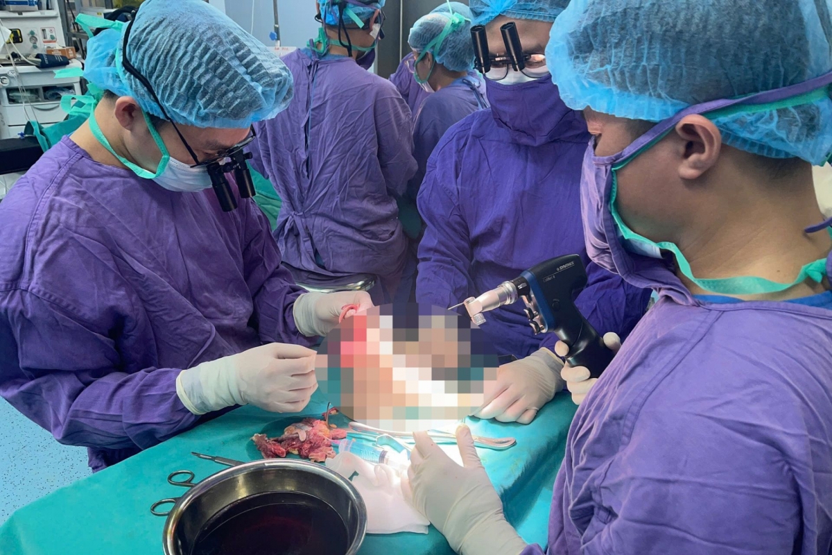 Nối thành công chân đứt lìa cho cô gái 19 tuổi bị xe tông ở Hà Nội