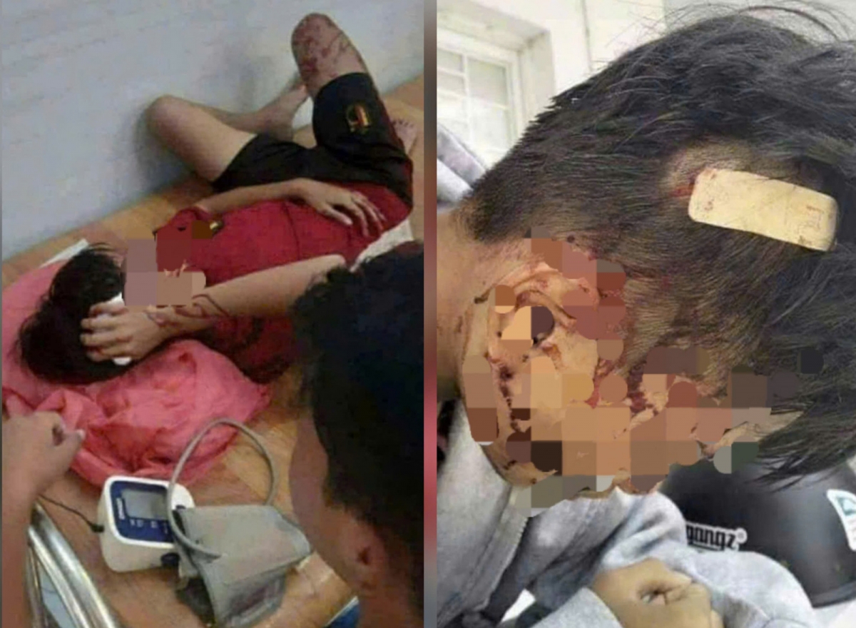 Rúng động các vụ bạo lực học đường gây hậu quả đau lòng trong năm 2025