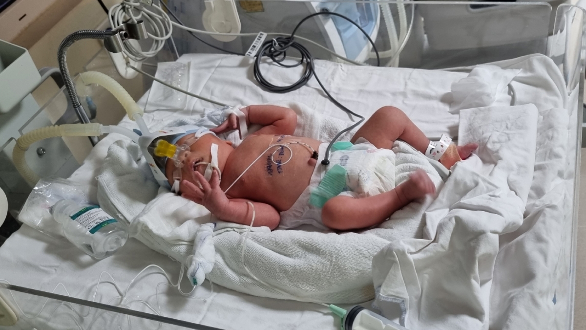 Lồng ấp - giữ sự sống cho trẻ sinh non