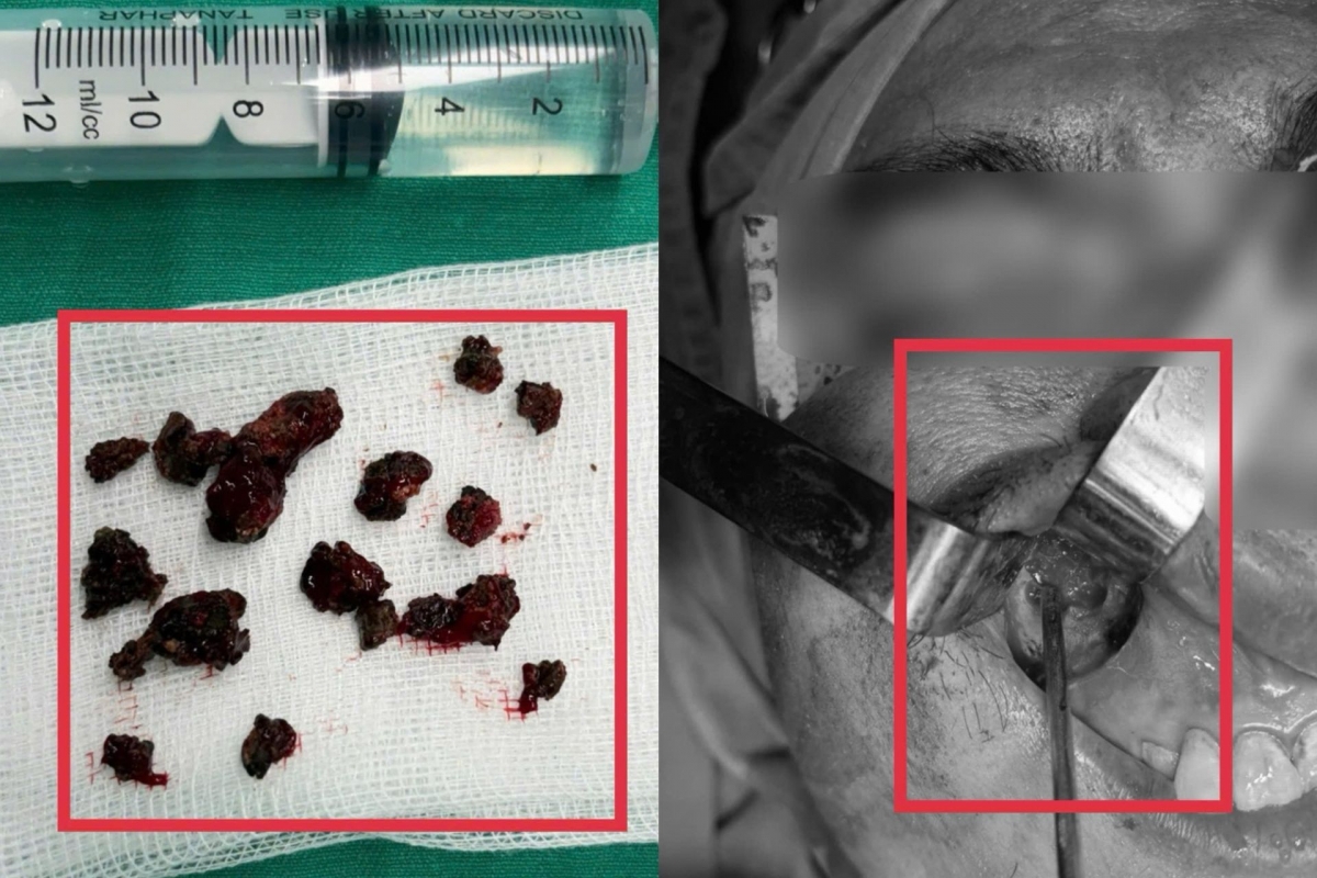 nam den an mon xuong xoang ham nguoi dan ong khoe manh hinh anh 1