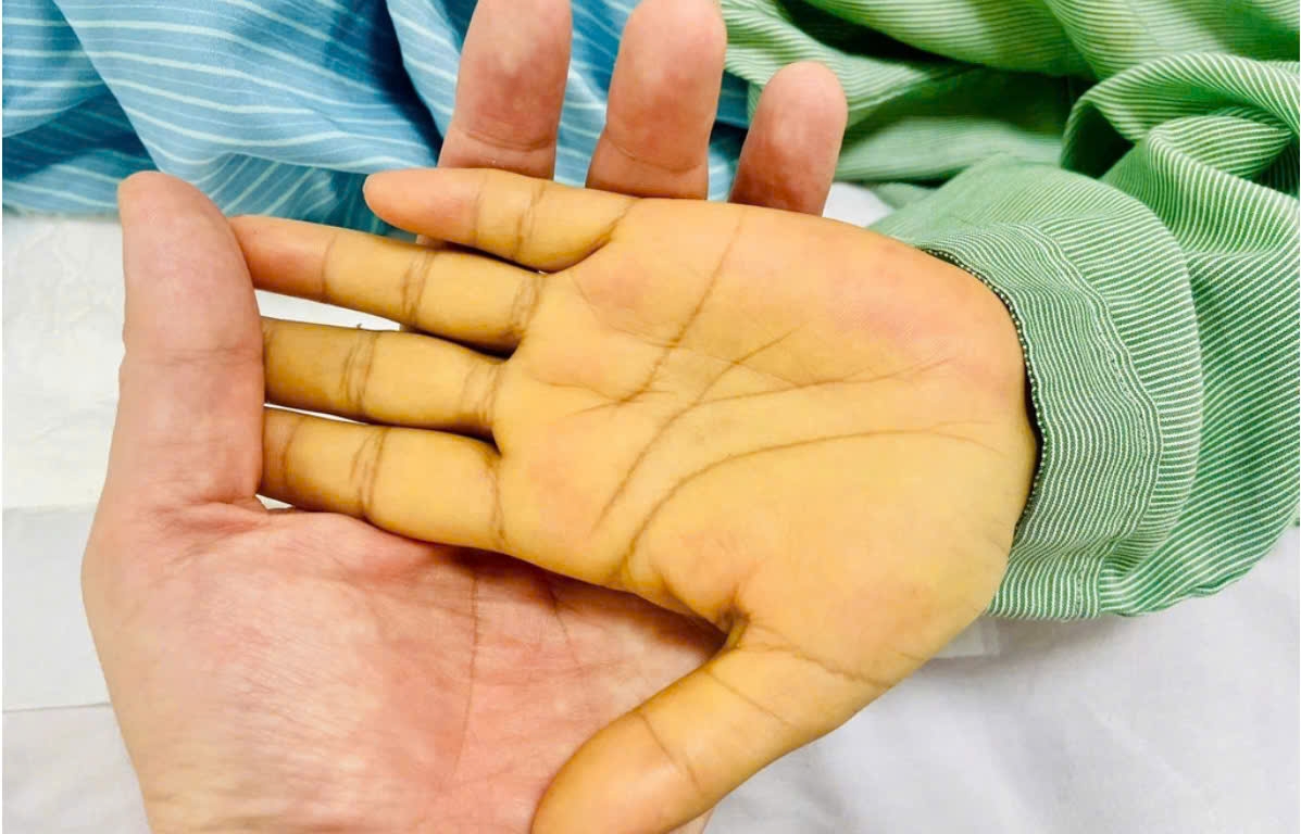 2 vị trí có màu vàng cảnh báo nguy hiểm không nên bỏ qua