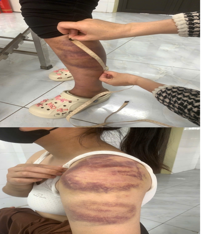 Tạm giữ người đàn ông nhiều lần bạo hành vợ đang mang thai và con gái 13 tuổi