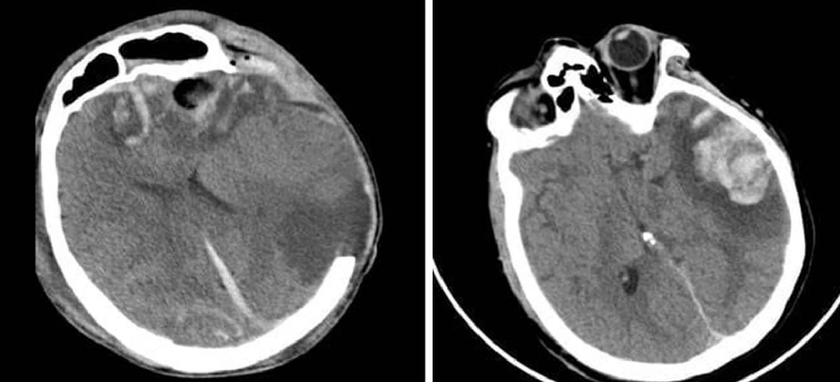 Russian mother and son saved after serious traffic accident in Vietnam