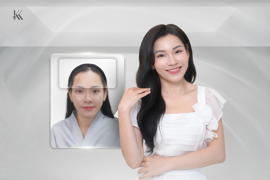 cay toc chuan y khoa - giai phap cho mai toc khoe dep hinh anh 3