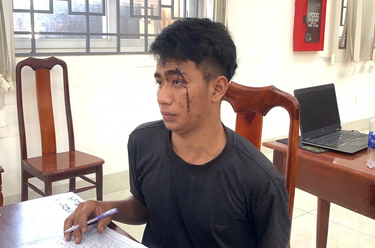 khong biet lai van trom o to, 2 thanh nien gay tai nan roi treo cay tron hinh anh 2